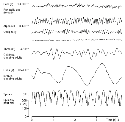 eeg2.gif